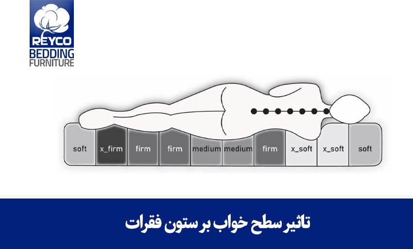 تاثیر سطح خواب بر ستون فقرات